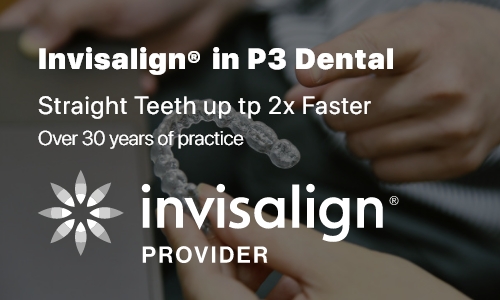 Invisalign