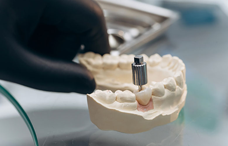 Restoration Dentistry Restoration Dentistry