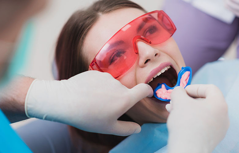Preventative Dentistry Preventative Dentistry