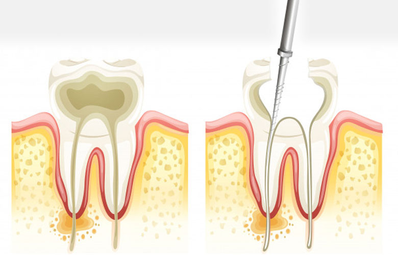Restoration Dentistry Restoration Dentistry