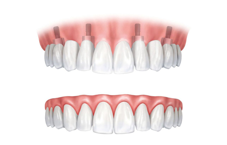 Restoration Dentistry Restoration Dentistry