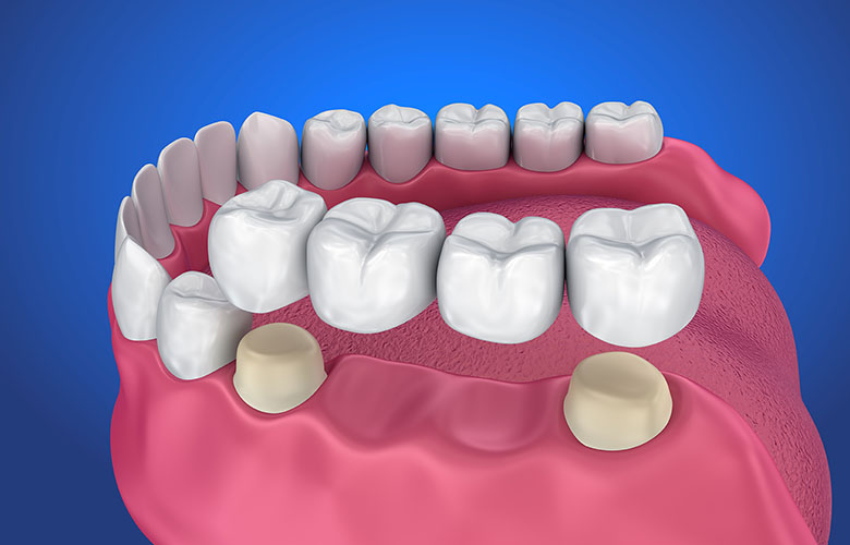 Cosmetic Dentistry Cosmetic Dentistry