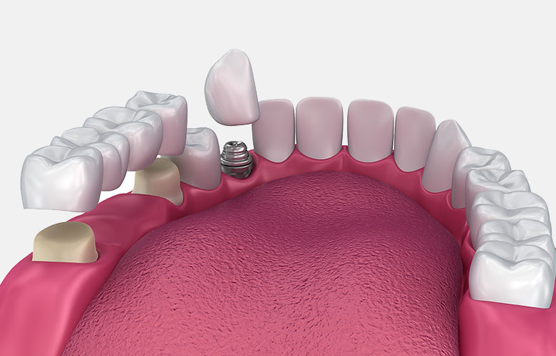 Cosmetic Dentistry Cosmetic Dentistry