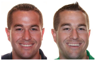 Treatment before after1 Treatment before after1