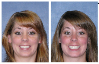 Treatment before after2 Treatment before after4